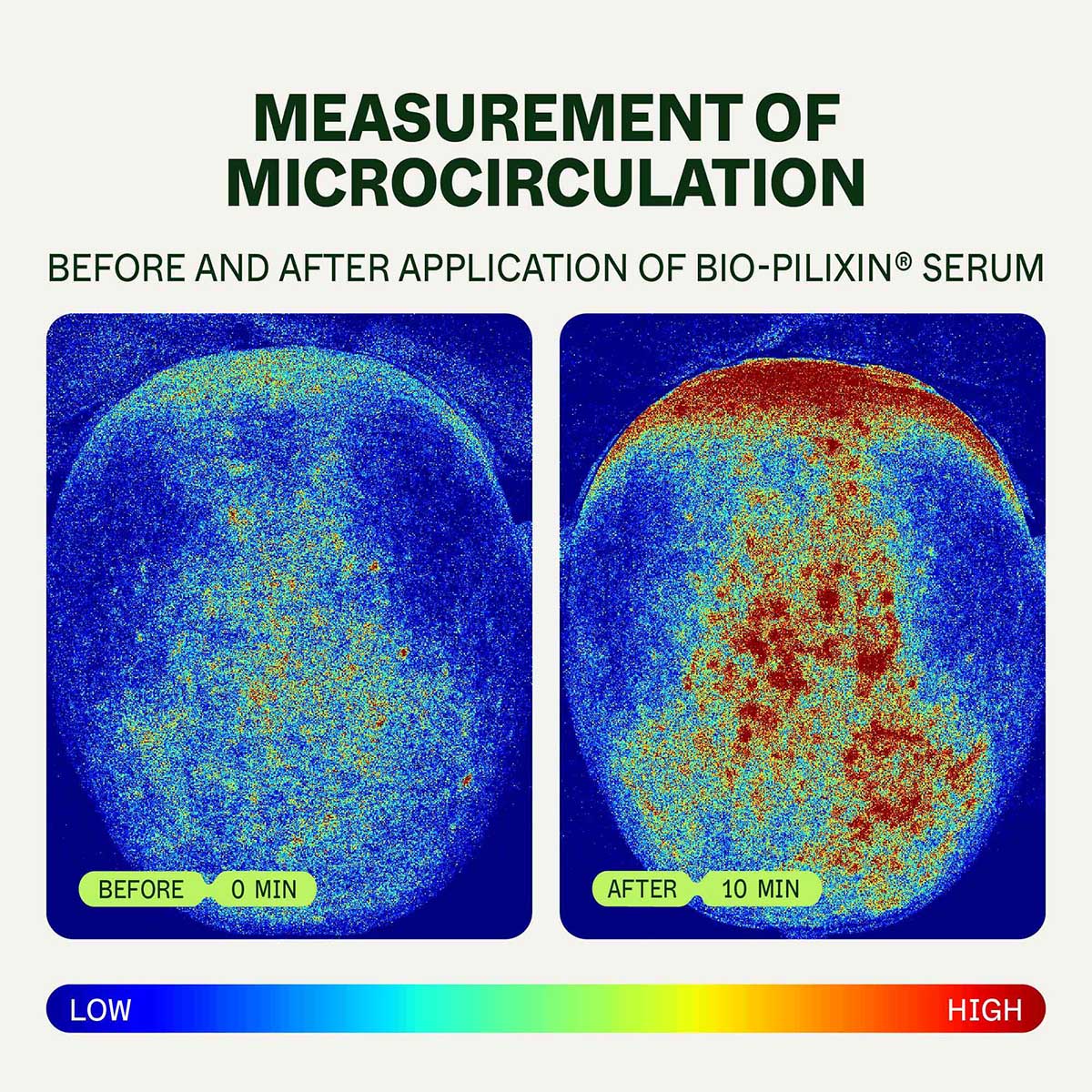 Bio-Pilixin Aktiverande Serum | För kvinnor