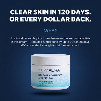 New Aura™ Men's Anti-Fungal Acne Cream