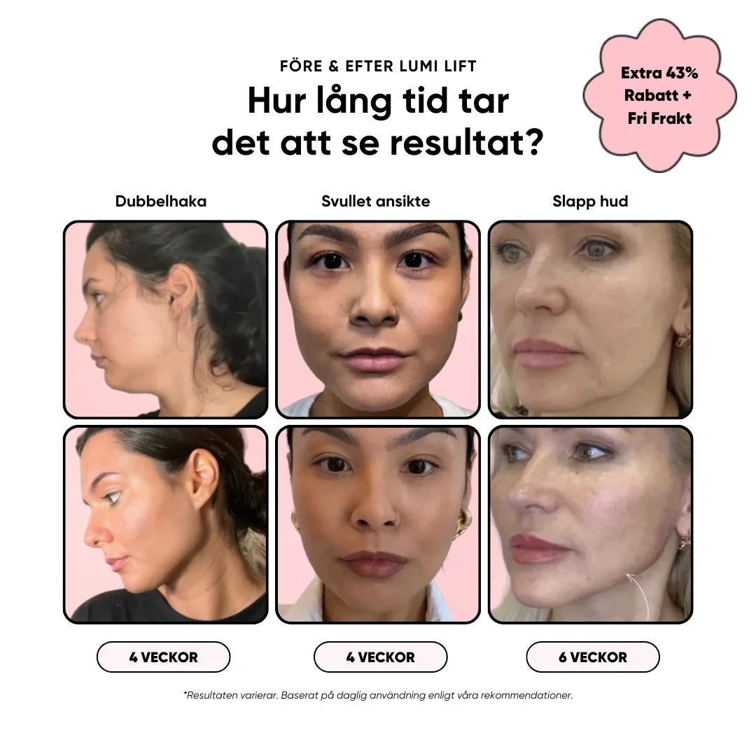 Lumi Lift